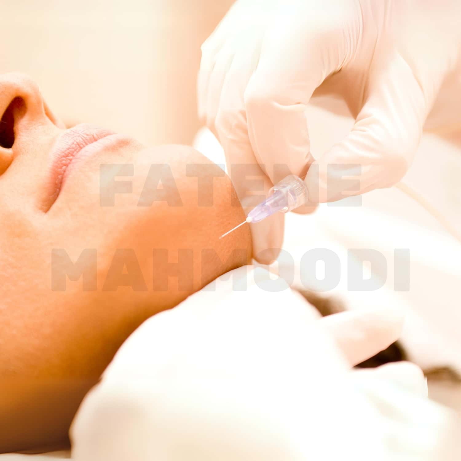 A woman recieving a carboxy therapy service